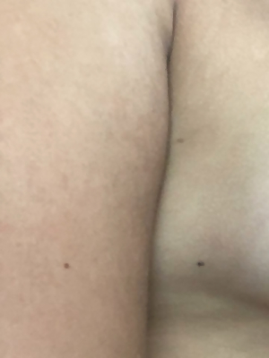 Tan Lines And Extra Puffiness ðŸ¤—